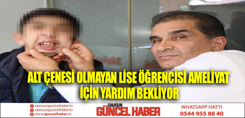 Alt çenesi olmayan lise öğrencisi ameliyat için yardım bekliyor