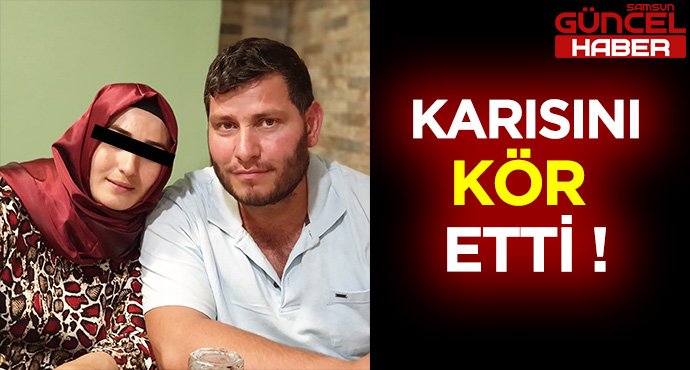 KARISINI KÖR ETTİ !