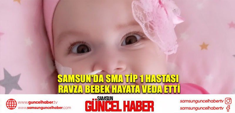 Samsun'da SMA Tip 1 Hastası Ravza Bebek Hayata Veda Etti