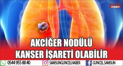 AKCİĞER NODÜLÜ KANSER İŞARETİ OLABİLİR