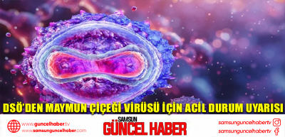 DSÖ’den maymun çiçeği virüsü için acil durum uyarısı