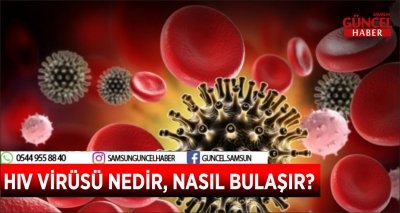 HIV VİRÜSÜ NEDİR, NASIL BULAŞIR?