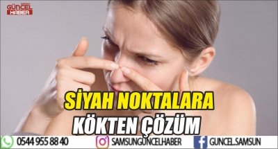 SİYAH NOKTALARA KÖKTEN ÇÖZÜM